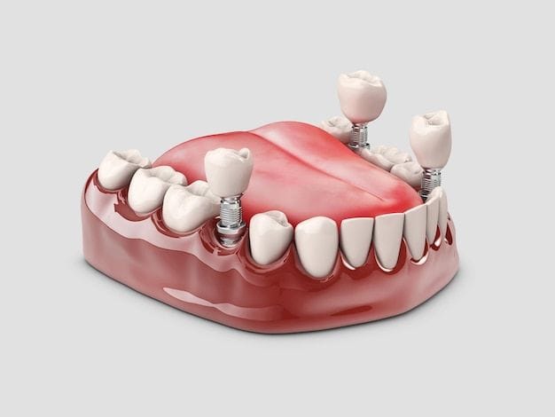 dental implants in Addis Ababa