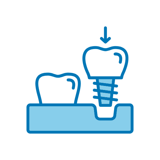 Dental Implant Service in Addis Ababa