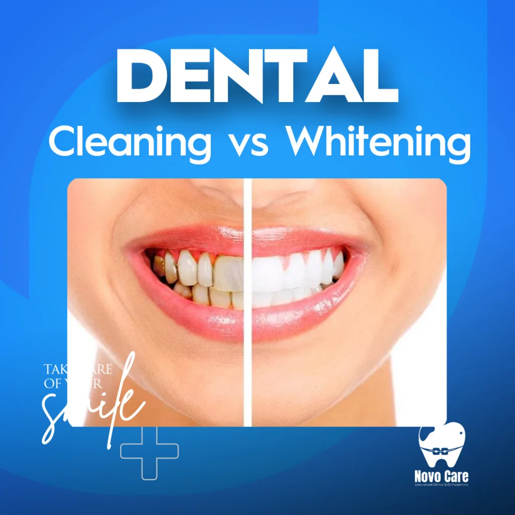Dental Cleaning vs Whitening
