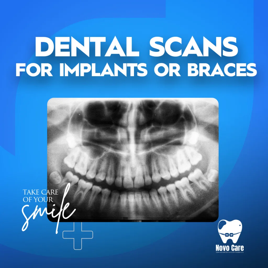 Dental Scans for Implants or Braces