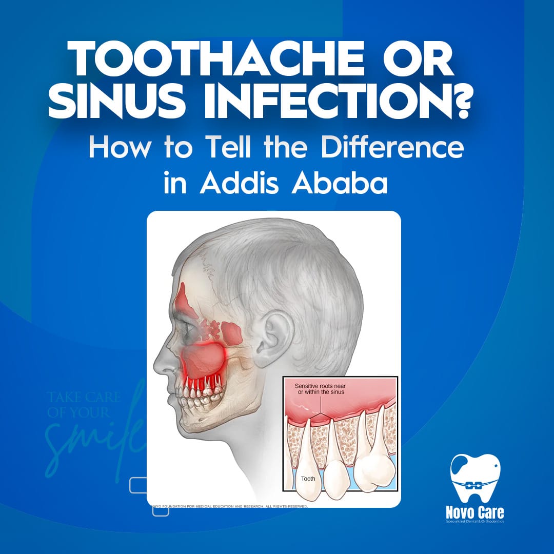 Toothache or Sinus Infection