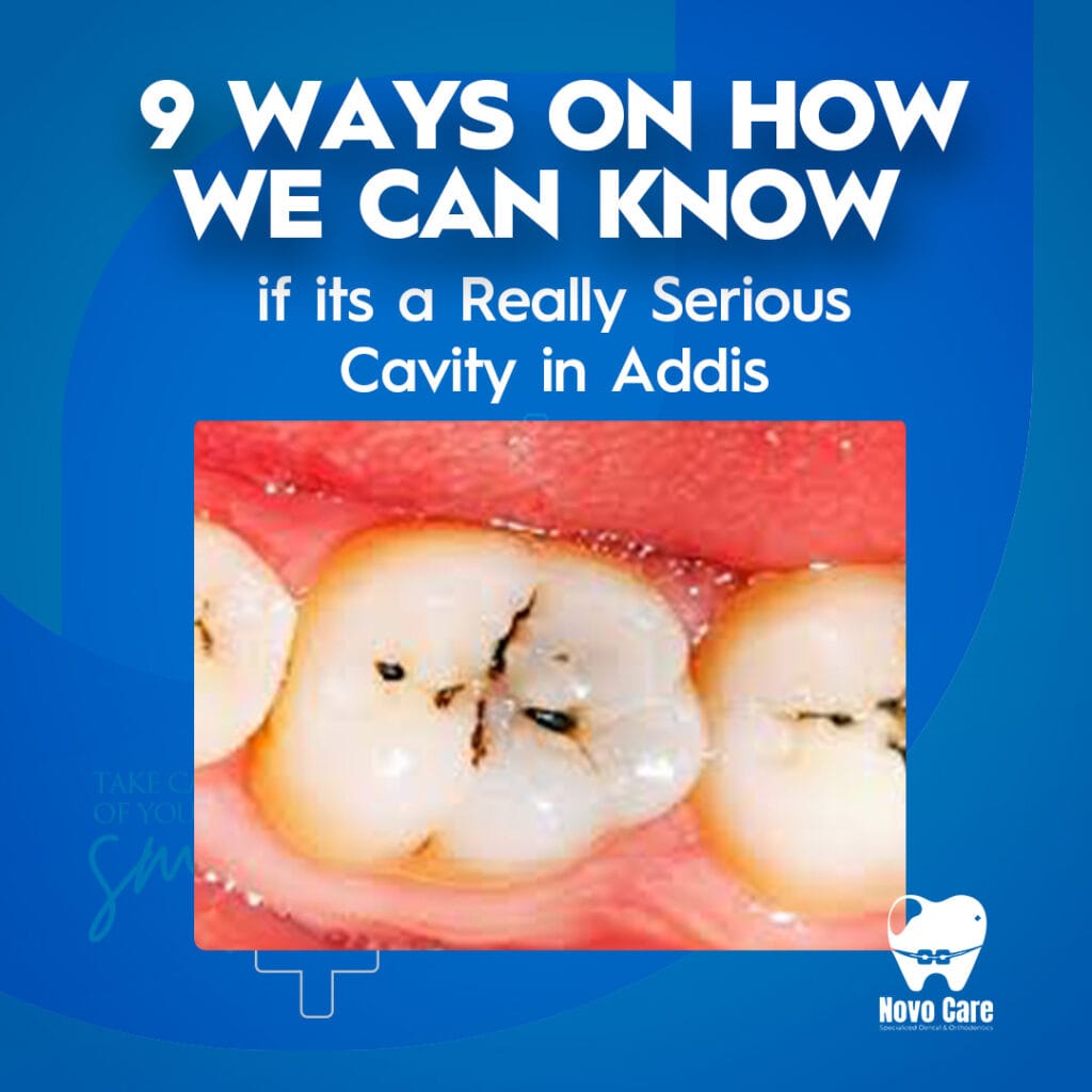 Serious Cavity in Addis