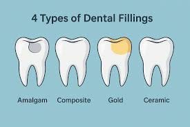 Dental Fillings in Addis Ababa