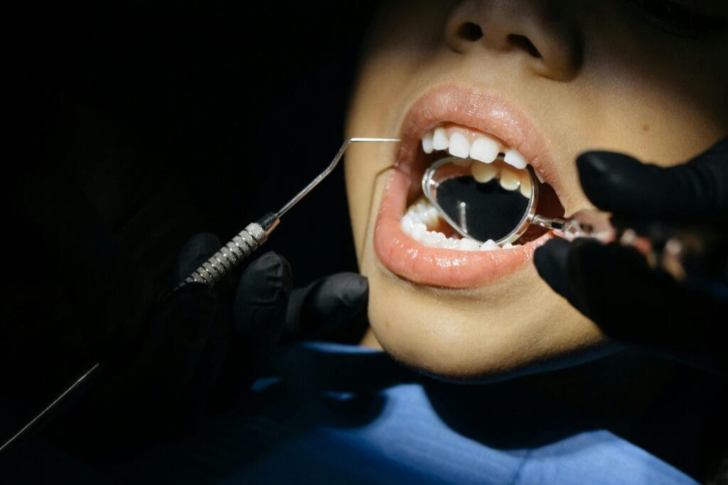 How to prevent Cavities_Novo Care_Addis Ababa