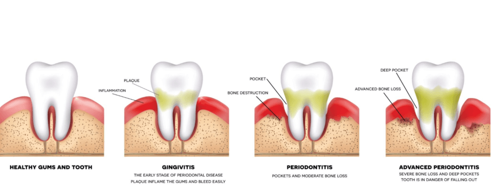 Periodontics_Novocare