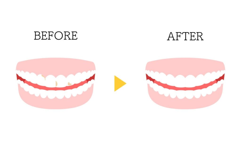 professional teeth cleaning in Addis Ababa_Novo care