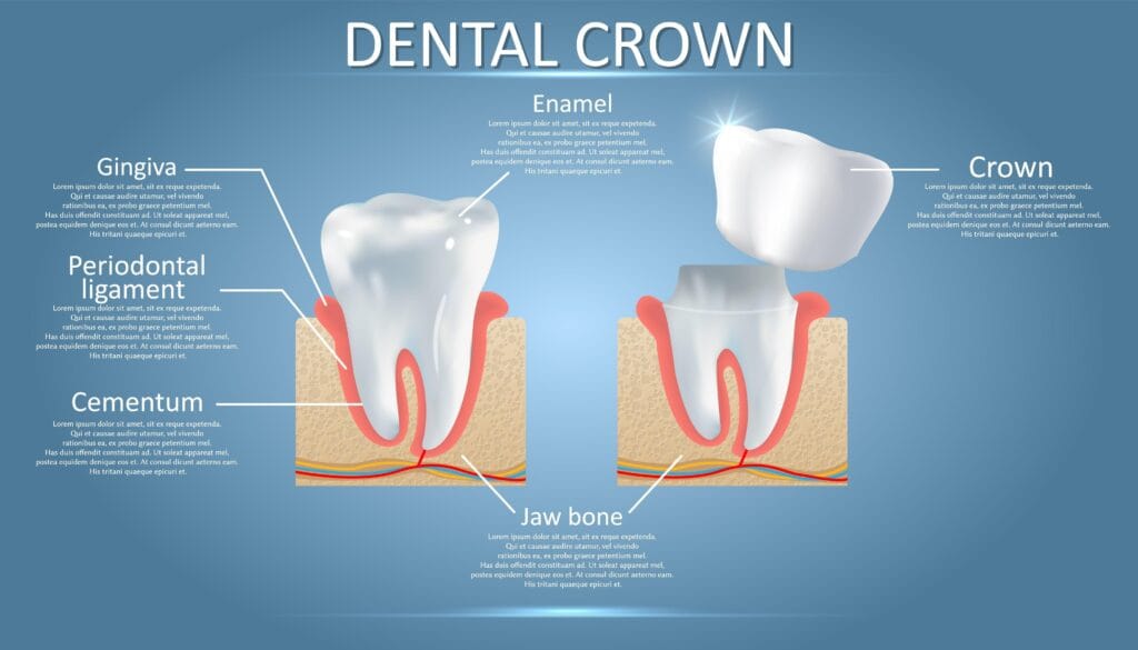 Teeth Whitening in Addis Ababa Novo Care